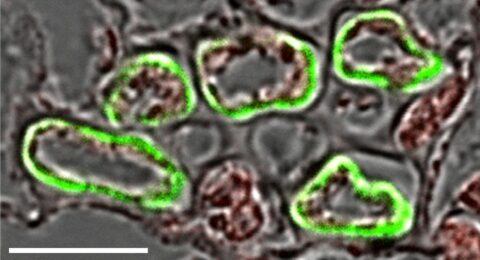 The image shows a cross section through a small vein from a leaf of a sugar beet plant. The section has been treated with an antiserum against the BvSUT1 protein. Binding of the antiserum to five companion cells results in a green fluorescence of these companion cells. Three smaller sieve elements that are surrounded by these companion cells are not decorated by the antiserum, indicating that they do not possess the BvSUT1 protein. The white bar is 10 µm (image: WILEY Blackwell)