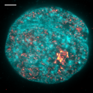 Image of transcription process in the nucleus taken using a super high-resolution microscope. The DNA is blue and the transcribing polymerase is yellow. The scale is 2 micrometres. (Copyright: Hilbert et al. / MPI-CBG)